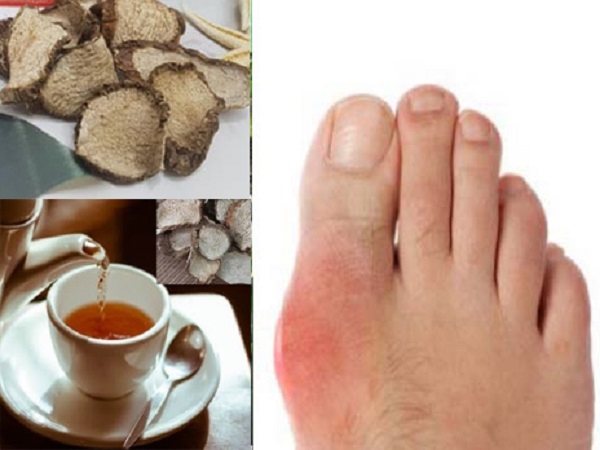 Hỗ trợ điều trị bệnh gout là câu trả lời củ ráy chữa bệnh gì